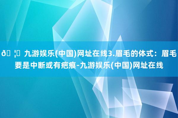 🦄九游娱乐(中国)网址在线3.眉毛的体式：眉毛要是中断或有疤痕-九游娱乐(中国)网址在线